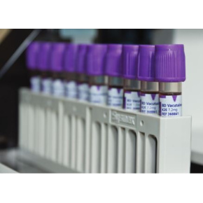 Skúmavka Vacutainer 3ml K3EDTA, 75x13 (100ks)